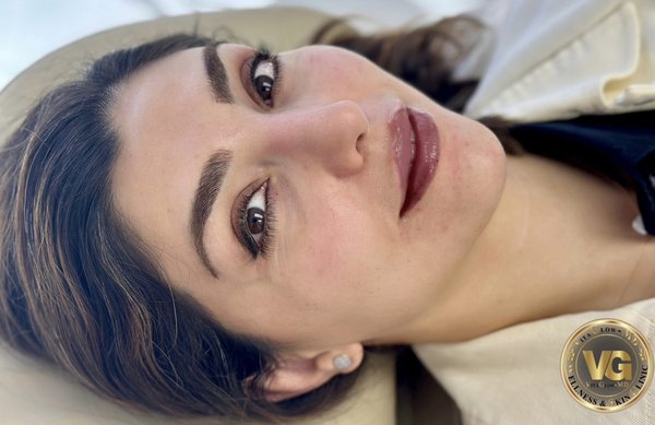 Perfect Your Pout: Expert Lip Filler Treatment - At VitaGlowMD, we specialize in natural-looking lip enhancements tailored to each individual’s features. Our before-and-after transformations showcase Dr. Famoori’s precision in sculpting lips with expert filler techniques, whether it’s subtle volume restoration, defining lip borders, or correcting asymmetry. With over 26 years of experience, Dr. Famoori carefully customizes every treatment to achieve balanced, harmonious, and long-lasting results. Perfect Your Pout: Expert Lip Filler Treatment - At VitaGlowMD, we specialize in natural-looking lip enhancements tailored to each individual’s features. Our before-and-after transformations showcase Dr. Famoori’s precision in sculpting lips with expert filler techniques, whether it’s subtle volume restoration, defining lip borders, or correcting asymmetry. With over 26 years of experience, Dr. Famoori carefully customizes every treatment to achieve balanced, harmonious, and long-lasting results.