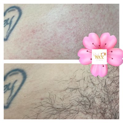 Glow Down Below - Brazilian Waxes & Vajacials will make your skin GLOW! Glow Down Below - Brazilian Waxes & Vajacials will make your skin GLOW!