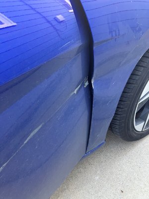 Motor Vehicle Accident - Bakersfield - This was a recent case our firm handled where the client was 4.5 months pregnant at the time of the accident. The at-fault insurance company admitted fault on behalf of their negligent driver once we proved a theory of liability. Our office diligently pursued the matter and obtained a settlement for our client within six months after the accident. Contact our firm immediately if you are injured due a car accident. Motor Vehicle Accident - Bakersfield - This was a recent case our firm handled where the client was 4.5 months pregnant at the time of the accident. The at-fault insurance company admitted fault on behalf of their negligent driver once we proved a theory of liability. Our office diligently pursued the matter and obtained a settlement for our client within six months after the accident. Contact our firm immediately if you are injured due a car accident.