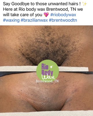 Rio body wax Brentwood TN - With, Rio body wax 🍯 Your skin will be softer and smoother after waxing, don't shave your hair, just wax! Say goodbye to ingrown hairs! Rio body wax Brentwood TN - With, Rio body wax 🍯 Your skin will be softer and smoother after waxing, don't shave your hair, just wax! Say goodbye to ingrown hairs!