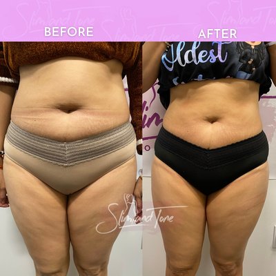 Before and after photos - These are photos of past or current clients who made the steps to obtain their dream bodies.
Check out the amazing changes our clients experience in their body! Before and after photos - These are photos of past or current clients who made the steps to obtain their dream bodies.
Check out the amazing changes our clients experience in their body!