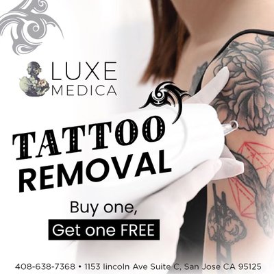 Now offering Tattoo removal! - Our new tattoo removal service is aimed to please! Now offering Tattoo removal! - Our new tattoo removal service is aimed to please!