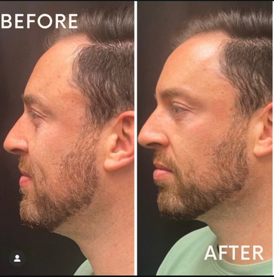 "looking to improve your health & Beauty?" - At Revive By Aviva, we believe that true beauty comes from within—and we're here to help you shine. Through our unique approach to **Aesthetic Coaching** and **skincare**, we guide you on a personalized journey to enhance your natural radiance. Our expert team takes the time to understand your individual beauty goals, tailoring every service to meet your needs.
With aesthetic coaching, we empower you to not only look your best but feel confident in your own skin. From advice on lifestyle choices to customized skincare routines, we help you make informed decisions that support your beauty from the inside out. Whether you're looking to refresh your look or address specific concerns, Revive By Aviva offers a transformative experience that leaves you glowing—inside and out. "looking to improve your health & Beauty?" - At Revive By Aviva, we believe that true beauty comes from within—and we're here to help you shine. Through our unique approach to **Aesthetic Coaching** and **skincare**, we guide you on a personalized journey to enhance your natural radiance. Our expert team takes the time to understand your individual beauty goals, tailoring every service to meet your needs.
With aesthetic coaching, we empower you to not only look your best but feel confident in your own skin. From advice on lifestyle choices to customized skincare routines, we help you make informed decisions that support your beauty from the inside out. Whether you're looking to refresh your look or address specific concerns, Revive By Aviva offers a transformative experience that leaves you glowing—inside and out.