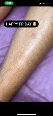 Leg waxing - Full leg - $70
Half leg - $40