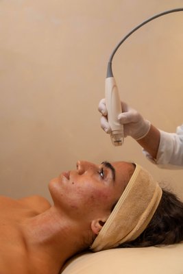 Vivace RF - Does it make a difference? Of course it does, Vivace microneedle is unbelievable! Let's be honest, at any age, we want to look our best—naturally, without giving up on the good things in life. Our goal is to age gracefully, elegantly, and beautifully yet still have fun. Vivace RF - Does it make a difference? Of course it does, Vivace microneedle is unbelievable! Let's be honest, at any age, we want to look our best—naturally, without giving up on the good things in life. Our goal is to age gracefully, elegantly, and beautifully yet still have fun.