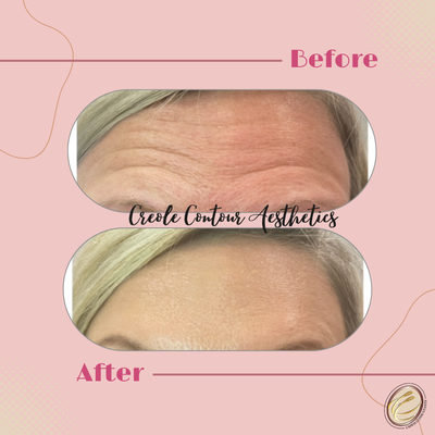 "Ready to put those wrinkles in time out?' - "Unapologetically You, fewer frown lines!"