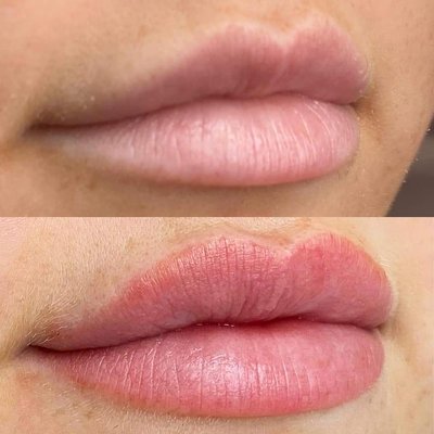 Lip blush - LIP BLUSH IS A SEMI-PERMANENT MAKE UP TECHNIQUE THAT IS DONE BY MACHINE TO ENHANCE THE NATURAL COLOR AND SHAPE OF THE LIPS. DEPOSITING THE PIGMENT INTO THE LIPS WILL ALLOW THE LIPS TO HAVE A FULLER AND MORE DEFINED LOOK. THIS PROCEDURE TAKES ROUGHLY 3 HOURS TO COMPLETE AND WILL NEED A FOLLOW UP APPOINTMENT BOOKED BETWEEN 6-8 WEEKS FROM THE INITIAL APPOINTMENT. LIP BLUSH LASTS UP TO THREE YEARS!  

TIME: 2.5-3 HOURS 
PAIN LEVEL: 0 - MINIMAL 
NUMBING: TOPICAL ANESTHETIC APPLIED 
HEALING TIME: 10-14 DAYS