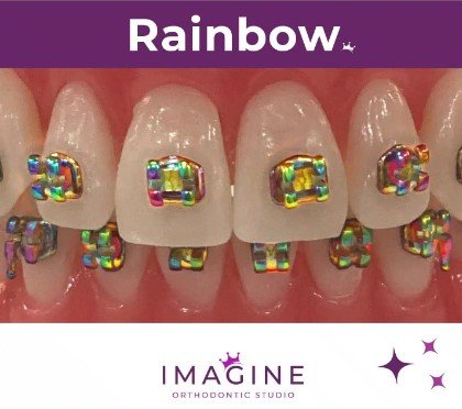 Braces in Many Colors! - Contemporary braces options feature attractive and low-profile components that can either accentuate — or blend into — your smile. Plus, you can customize the brackets and elastics with finishes in gold, rose gold, rainbow, royal blue, or classic black and silver! Other options like Invisalign use a series of invisible and removable aligners that no one can tell you’re wearing. Braces in Many Colors! - Contemporary braces options feature attractive and low-profile components that can either accentuate — or blend into — your smile. Plus, you can customize the brackets and elastics with finishes in gold, rose gold, rainbow, royal blue, or classic black and silver! Other options like Invisalign use a series of invisible and removable aligners that no one can tell you’re wearing.