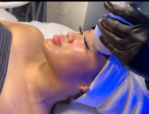 CryoSkin facial treatment - With this non-surgical facelift, you can see the results immediately after one session. CryoSkin 3.0 facial can stimulate primary collagen production, lift the face, and visibly reduce wrinkles.
A CryoSkin Facial treatment widens blood vessels in the face (called vasodilation), which allows increased blood flow, leading to more collagen production. This treatment decreases signs of aging or wrinkles. This treatment is known to improve the elasticity of the skin. CryoSkin facial treatment - With this non-surgical facelift, you can see the results immediately after one session. CryoSkin 3.0 facial can stimulate primary collagen production, lift the face, and visibly reduce wrinkles.
A CryoSkin Facial treatment widens blood vessels in the face (called vasodilation), which allows increased blood flow, leading to more collagen production. This treatment decreases signs of aging or wrinkles. This treatment is known to improve the elasticity of the skin.