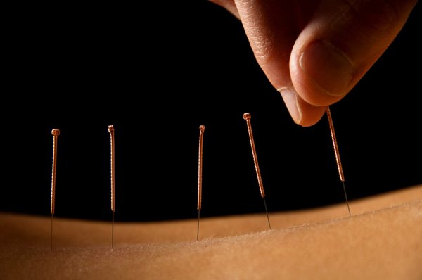 Traditional Chinese Medicine - Trained at one of the very finest Acupuncture and Chinese Medicine institutes in the world, we specialize in diagnostics. We believe that the foundation of excellence in Chinese Medicine lies in identifying exactly why a certain condition is manifesting in your body at this particular moment. To this end, we have studied with some of the best Chinese medicine diagnosticians in the world to learn how to read your channels and understand what your body needs. Whether that is a simple tune up of your acupuncture channels, moxibustion, core synchronism, specific stretches, microcurrent, or Chinese herbs, it will be included in your treatment.
We had the great fortune of attending acupuncture school at the Seattle Institute of East Asian Medicine. This small institute is unique in its selectivity of both applicants and teachers. As an extremely rigorous apprenticeship-style school, SIEAM is considered by many to be the best acupuncture school in the world. While there, we had the privilege of learning from some of the leaders in the field of Chinese Medicine such as Dan Bensky, DO, Craig Mitchell, PhD., and Steven Brown, L.Ac.
https://www.facebook.com/perfectpointacupuncture Traditional Chinese Medicine - Trained at one of the very finest Acupuncture and Chinese Medicine institutes in the world, we specialize in diagnostics. We believe that the foundation of excellence in Chinese Medicine lies in identifying exactly why a certain condition is manifesting in your body at this particular moment. To this end, we have studied with some of the best Chinese medicine diagnosticians in the world to learn how to read your channels and understand what your body needs. Whether that is a simple tune up of your acupuncture channels, moxibustion, core synchronism, specific stretches, microcurrent, or Chinese herbs, it will be included in your treatment.
We had the great fortune of attending acupuncture school at the Seattle Institute of East Asian Medicine. This small institute is unique in its selectivity of both applicants and teachers. As an extremely rigorous apprenticeship-style school, SIEAM is considered by many to be the best acupuncture school in the world. While there, we had the privilege of learning from some of the leaders in the field of Chinese Medicine such as Dan Bensky, DO, Craig Mitchell, PhD., and Steven Brown, L.Ac.
https://www.facebook.com/perfectpointacupuncture