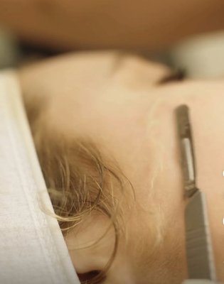Dermaplane - Dermaplane