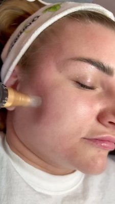 Face cleansing procedure - What is face cleansing at salon?
Clean up vs Facial - Which is better? | Bodycraft Salon
In comparison to facials, a face clean up is a grooming treatment that is focused on cleaning and exfoliating your skin. This typically involves using a variety of skincare products, such as cleansers, toners, and scrubs, to remove dirt, oil, and other impurities from the skin Face cleansing procedure - What is face cleansing at salon?
Clean up vs Facial - Which is better? | Bodycraft Salon
In comparison to facials, a face clean up is a grooming treatment that is focused on cleaning and exfoliating your skin. This typically involves using a variety of skincare products, such as cleansers, toners, and scrubs, to remove dirt, oil, and other impurities from the skin