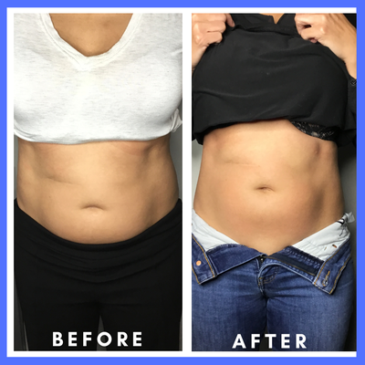 Cryogen treatments - Our revolutionary treatments target stubborn areas to help you look and feel your best — no surgery, no downtime.
*Those with localized fat deposits that are resistant to diet and exercise.
*Individuals seeking body contouring without undergoing surgery.
*Men and women of varying fitness levels looking to enhance their natural shape.