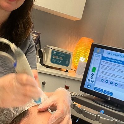 Anti aging treatments, skin care - The HydraFacial is one of the most popular in-office facial treatments right now. It's so popular, that one is performed every 15 seconds around the world. That stat alone is impressive, but the treatment's become the go-to facial for celebs, your co-worker, and Instagram mutuals because it targets many of the most common skincare concerns like dryness and signs of aging with little to no side effects.
The VI peel is a medical-grade chemical peel used to treat a multitude of cosmetic concerns, and it is effective for all skin types and colors. VI peels are useful for addressing aesthetic concerns typically related to the aging process. As we age, the skin loses elasticity and can become unevenly pigmented. Anti aging treatments, skin care - The HydraFacial is one of the most popular in-office facial treatments right now. It's so popular, that one is performed every 15 seconds around the world. That stat alone is impressive, but the treatment's become the go-to facial for celebs, your co-worker, and Instagram mutuals because it targets many of the most common skincare concerns like dryness and signs of aging with little to no side effects.
The VI peel is a medical-grade chemical peel used to treat a multitude of cosmetic concerns, and it is effective for all skin types and colors. VI peels are useful for addressing aesthetic concerns typically related to the aging process. As we age, the skin loses elasticity and can become unevenly pigmented.