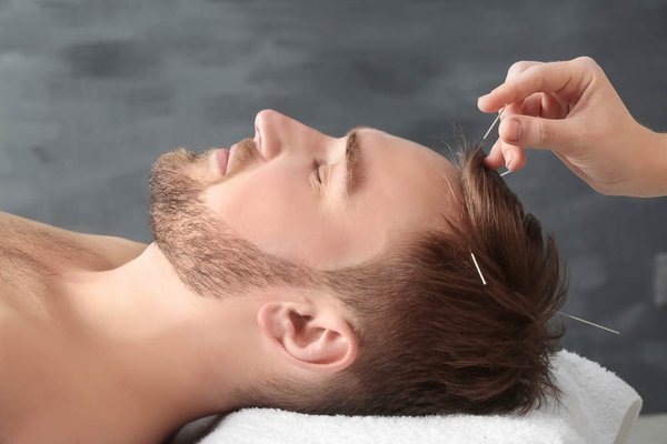 Discover the Benefits of Scalp Acupuncture! - Looking for relief from stress, migraines, or neurological issues? Scalp acupuncture is a gentle, effective technique that targets key points on the scalp to promote healing and improve overall well being. Curious if it’s right for you? Call today!