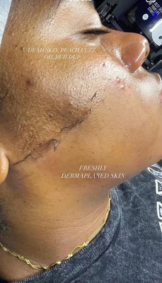 Facial/Dermaplaning Treatment - Facial/Dermaplaning Treatment - call to book!