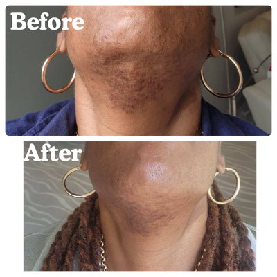 Beauty - We specifically specialize in achieving results with your skin, body sculpting and lashes. We use proven techniques by trainers from Columbia, Brazil, Paris and South Korea. Our training has allowed us to use different techniques to give you results. Our one on one treatments will definitely help you with a customized and personal treatment plan and coach. ￼