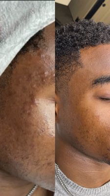 Custom Facial Treatments - Custom facial treatments tailored to your skins needs.