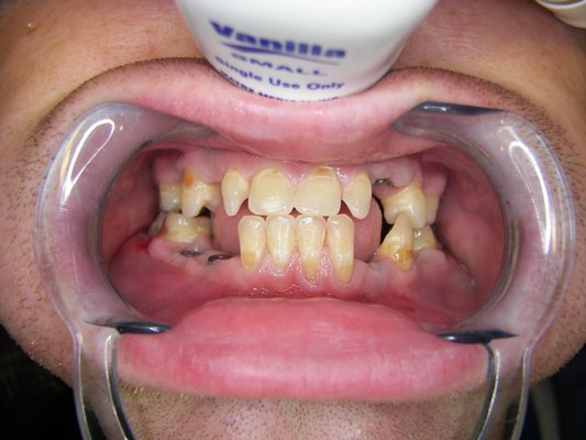 New Patients - Robert C Goldtrap DDS is the new owner of Lifestyle dentistry. Offering new patients free initial cleaning if no insurance and 20% new treatment plan New Patients - Robert C Goldtrap DDS is the new owner of Lifestyle dentistry. Offering new patients free initial cleaning if no insurance and 20% new treatment plan