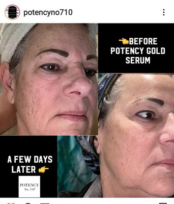 Amazing benefits of Potency 710 Gold Face Serum - The Gold Skin Serum is jam-packed with over 20 of the world's most sought-after plant oils. We bring you the newest ingredient to disrupt the beauty industry (CBD). This full-spectrum CBD & CBG serum is uniquely blended together with oils like blue tansy, frankincense, sandalwood, and rose oil. In other words, it makes it incredibly potent. Super-effective and multi-functional with a zen like smell.

The essential oils are of course non-toxic, yet-powerful. Delivering an abundance of antioxidants and vitamins. 

CBD oil is said to be the most unsaturated oil in the plant kingdom, Our Gold serum absorbs into the skin but without clogging pores. The transformation is so real we encourage before & after photos.

KEY INGREDIENTS

Full Spectrum CBD Oil is full of Omega 3,6, and 9 and rich in many supplements that help slow the aging process.
Camellia Seed is a powerful anti-aging antioxidant.
Jojoba Oil is naturally anti-inflammatory, antibacterial, and moisturizing.
Argan Oil is a non-greasy, non-irritating natural moisturizer.
Coconut Oil provides a soothing topical barrier.
Spruce Leaf Oil is anti-infectious and anti-viral.
Ho Wood Leaf naturally calms and is also an anti-fungal.
Frankincense protects skin cells and lifts and tightens.
Blue Tansy Flower + Blue Chamomile Flower balances, calms, and hydrates.
Osmanthus Flower keeps skin healthy and glowing.
Bergamot Peel smells amazing and purifies the skin.
Ylang Ylang promotes relaxation, balances, and is a well-known aphrodisiac.
Patchouli Leaf is a healing antiseptic.
Vanilla CO2 is a natural antioxidant.
Jasmine Flower evens skin-tone and adds moisture.
Cinnamon Bark eliminates acne by drying the skin and bringing blood and oxygen to the surface.
Cistus Leaf heals, tones, and tightens.
Vetiver Root reduces dark spots.
Sandalwood reduces the signs of aging and exfoliates.
Cocoa Seed repairs skin cells protects against free radicals.
Rose Flower provides a gorgeous glow.
Vitamin E blocks free radicals, keeping wrinkles at bay.