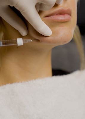 Jawline Profile Filler - Jawline Profile Contour Filler Jawline Profile Filler - Jawline Profile Contour Filler