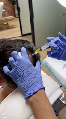 PRP Hair Restoration - ✨ Introducing our cutting-edge PRP Hair Restoration treatment, the secret to thick, luscious locks. 🌟 Experience the power of Platelet-Rich Plasma, as we stimulate natural hair growth, strengthen follicles, and rejuvenate your scalp. Say hello to healthier, fuller hair and a boost in self-assurance. Book your appointment today and embark on your journey to luxurious tresses! 💇♂️💆♀️ PRP Hair Restoration - ✨ Introducing our cutting-edge PRP Hair Restoration treatment, the secret to thick, luscious locks. 🌟 Experience the power of Platelet-Rich Plasma, as we stimulate natural hair growth, strengthen follicles, and rejuvenate your scalp. Say hello to healthier, fuller hair and a boost in self-assurance. Book your appointment today and embark on your journey to luxurious tresses! 💇♂️💆♀️