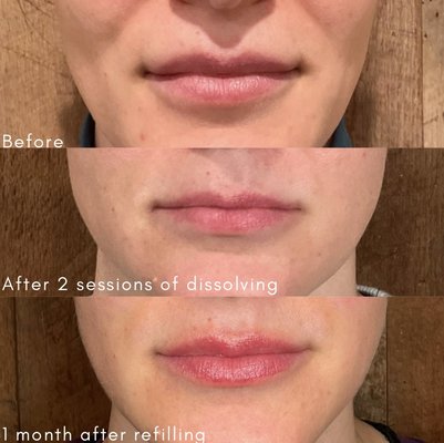 Before and Afters - We believe in the power of science and nature combined to enhance your natural beauty, inside and out.