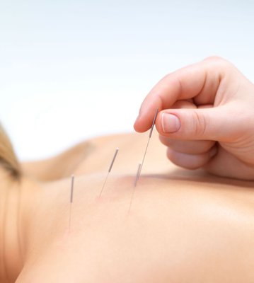Traditional Chinese Medicine - Chinese medicine uses over 5,000 years of knowledge to treat today's illnesses. Dr. Du has been operating acupuncture clinics for over 30 years, and is internationally know for her ability in Chinese Medicine. Traditional Chinese Medicine - Chinese medicine uses over 5,000 years of knowledge to treat today's illnesses. Dr. Du has been operating acupuncture clinics for over 30 years, and is internationally know for her ability in Chinese Medicine.