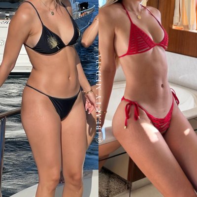 Weight loss - Our medical weight loss injections are formulated with clinically proven compounds to safely reduce appetite and increase fat metabolism. This targeted approach supports sustained weight management and overall health improvement.