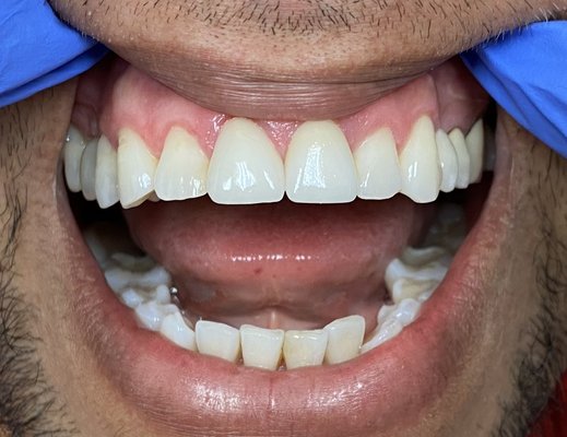 Cosmetic Dentistry - Going to the dentist should be easy, stress-free, and rejuvenating! We are a husband and wife team focused on what matters most, you and your family. With a general dentist and pediatric dental specialist, our office can treat patients of all ages. Combining the latest technology, refreshing design, and a warm friendly staff, we aim to give you a unique, transformative dental experience- one that does not have a “dental office” feeling. Each visit will be personalized, enjoyable, and empowering.
Every time.