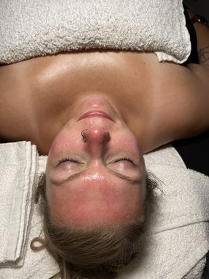 Facials - After shots of various facial treatments. Facials - After shots of various facial treatments.