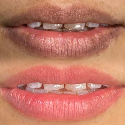 Lip Blush - This treatment helps neutralize dark lip pigmentation and enhance the natural beauty of the lips with a soft, fresh pink tone. Customized for each client’s unique lip base and goals. Lip Blush - This treatment helps neutralize dark lip pigmentation and enhance the natural beauty of the lips with a soft, fresh pink tone. Customized for each client’s unique lip base and goals.