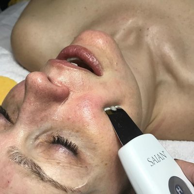 Dermaplaning Facial Treatment - Dermaplaning Facial Treatment Dermaplaning Facial Treatment - Dermaplaning Facial Treatment