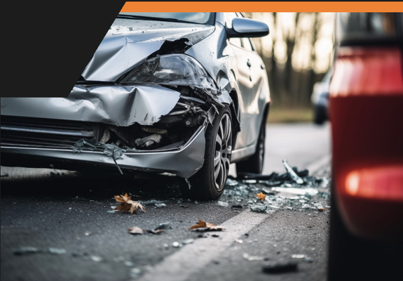 Collision Repair - When your vehicle suffers collision damage, you need expert technicians who understand the complexity of modern auto body repair. Corner Collision Center combines state-of-the-art computer measuring systems with I-CAR-certified expertise to restore your vehicle to factory specifications. Our facility at 1311 W 130th St Unit 7, Gardena, CA 90247 utilizes computerized frame straightening equipment that precisely measures and corrects structural damage to millimeter accuracy. Collision Repair - When your vehicle suffers collision damage, you need expert technicians who understand the complexity of modern auto body repair. Corner Collision Center combines state-of-the-art computer measuring systems with I-CAR-certified expertise to restore your vehicle to factory specifications. Our facility at 1311 W 130th St Unit 7, Gardena, CA 90247 utilizes computerized frame straightening equipment that precisely measures and corrects structural damage to millimeter accuracy.