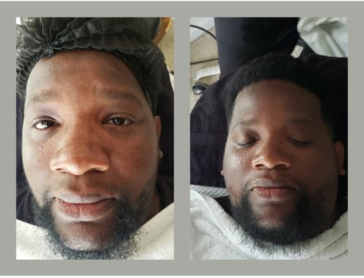 Gentlemen's Facial w/Beard Treatment - Gentlemen's Facial included a deep double-cleansing, enzyme exfoliation, manual extractions, high frequency treatment, series of hydrating serums and customized clay mask with hydrating moisturizer. Beard Treatment included an organic aloe vera, manuka honey shampoo made by Get Juiced Company and organic beard conditioner with organic Greek yogurt. High Frequency to stimulate hair growth and kill bacteria. Beard Leave-In Conditioner, Beard Straightener, Beard Serum, Organic Noblemen Beard Balm & Beard Tonic by Get Juiced Gentlemen's Facial w/Beard Treatment - Gentlemen's Facial included a deep double-cleansing, enzyme exfoliation, manual extractions, high frequency treatment, series of hydrating serums and customized clay mask with hydrating moisturizer. Beard Treatment included an organic aloe vera, manuka honey shampoo made by Get Juiced Company and organic beard conditioner with organic Greek yogurt. High Frequency to stimulate hair growth and kill bacteria. Beard Leave-In Conditioner, Beard Straightener, Beard Serum, Organic Noblemen Beard Balm & Beard Tonic by Get Juiced