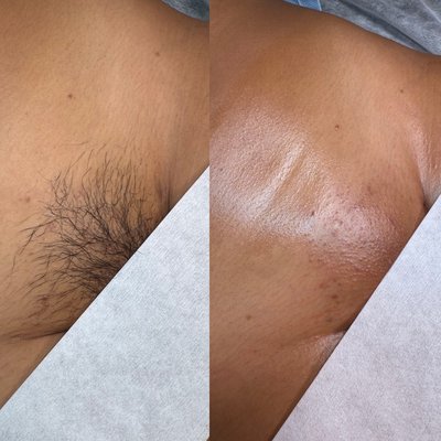 Body Waxing - Book a waxing service today! Body Waxing - Book a waxing service today!
