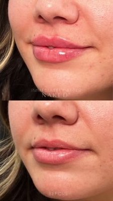 NAKEDMD - Updated May 2025 - 143 Photos & 150 Reviews - 27725 Santa