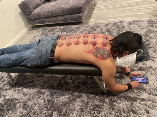 Cupping Therapy - Cupping therapy benefits: 
Decrease pain￼
Decrese spasm￼
Breaks scar tissue
Increase mobility