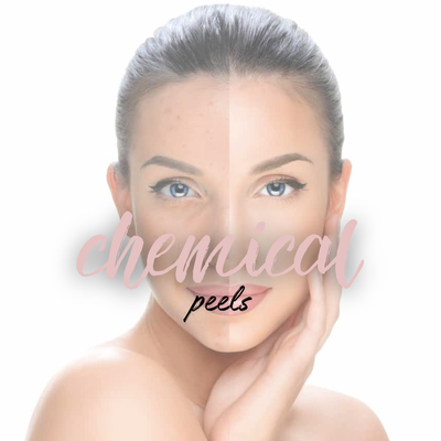 Chemical Peels & Skin Treatment - Achieve smoother, clearer skin with our VI Chemical Peel for the face, reducing fine lines, sun damage, and hyperpigmentation. Chemical Peels & Skin Treatment - Achieve smoother, clearer skin with our VI Chemical Peel for the face, reducing fine lines, sun damage, and hyperpigmentation.