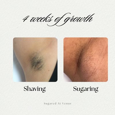 4 weeks of regrowth - Shaving Vs Sugaring - Sugaring reduces hair growth with just your first session. 4 weeks of regrowth - Shaving Vs Sugaring - Sugaring reduces hair growth with just your first session.