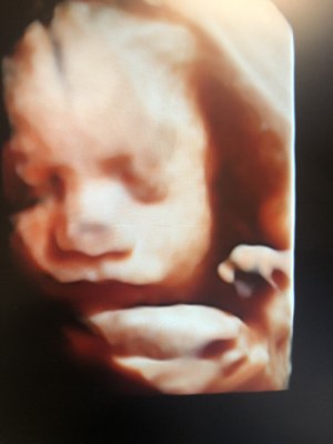 Hd Live & 3D Images♥️ - These Images are from pregnant mama’s that are over 30 weeks pregnant.?♥️ Hd Live & 3D Images♥️ - These Images are from pregnant mama’s that are over 30 weeks pregnant.?♥️