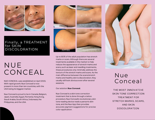 Skin Discoloration Treatment - Ask us about the details !