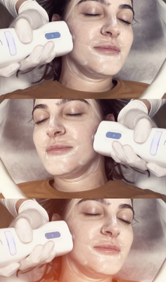 Glacial FX - Glacial skin is a refreshing, common treatment that brightens and stimulates, healthy, youthful skin. Every degree is important when it comes to skin health.
Glacial skin is a unique controlled, cooling treatment that can be tailored to your specific needs. It provides a refreshing and soothing experience while delivering real results for your skin. Glacial skin has a calming effect, making it an ideal treatment for anyone seeking relaxation.
The power of controlled cooling stimulates, healthy, beautiful skin by reducing redness, calming itchy, irritated skin, and soothing, and decreasing aches and soreness.
🧊 How many treatments are needed?
Treatments can be done as a one time treatment, added to other treatments or in a series. Best clinical results are seen when treatments are done in a series of treatments and as a part of a regular ongoing skin wellness routine.
🧊 What to expect after treatment?
Following glacial skin treatments, patients often expressed how relaxing and refreshing the experience was and how immediately their skin looks brighter, more hydrated, and refreshed. Glacial FX - Glacial skin is a refreshing, common treatment that brightens and stimulates, healthy, youthful skin. Every degree is important when it comes to skin health.
Glacial skin is a unique controlled, cooling treatment that can be tailored to your specific needs. It provides a refreshing and soothing experience while delivering real results for your skin. Glacial skin has a calming effect, making it an ideal treatment for anyone seeking relaxation.
The power of controlled cooling stimulates, healthy, beautiful skin by reducing redness, calming itchy, irritated skin, and soothing, and decreasing aches and soreness.
🧊 How many treatments are needed?
Treatments can be done as a one time treatment, added to other treatments or in a series. Best clinical results are seen when treatments are done in a series of treatments and as a part of a regular ongoing skin wellness routine.
🧊 What to expect after treatment?
Following glacial skin treatments, patients often expressed how relaxing and refreshing the experience was and how immediately their skin looks brighter, more hydrated, and refreshed.