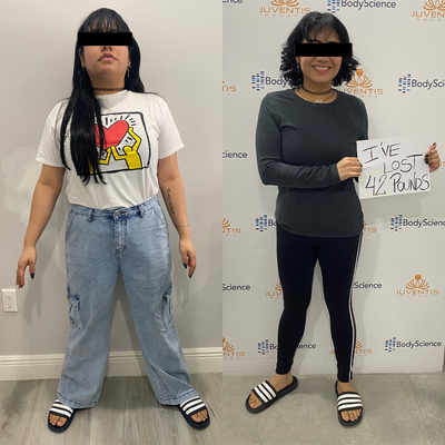 Loss Weight Success - One more success story! she lost the weight she wanted following one of our programs. Call for more information 305-448-0800