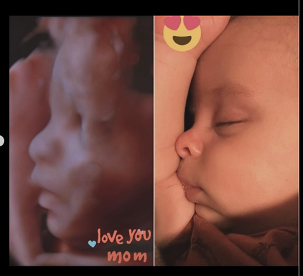 2D|3D|4D|5D Prenatal Imaging - 2D|3D|4D|5D Prenatal Imaging 2D|3D|4D|5D Prenatal Imaging - 2D|3D|4D|5D Prenatal Imaging