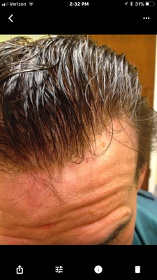 Some before and after photos of clients - A small portfolio of our work. some are just after photos and some ar before and after photos of different types of hair loss. Some before and after photos of clients - A small portfolio of our work. some are just after photos and some ar before and after photos of different types of hair loss.